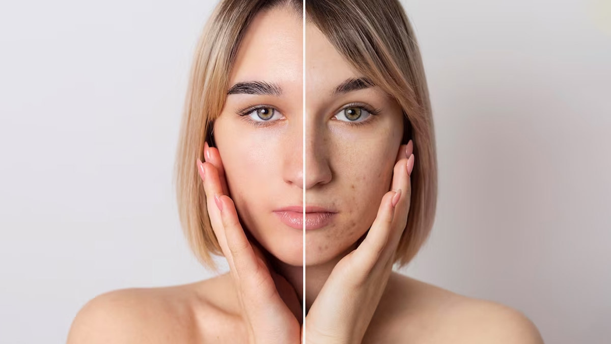 Say Goodbye to Dull Skin: Transforming Your Complexion with These Products